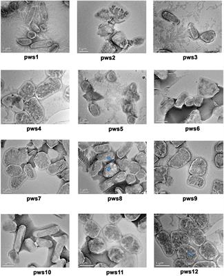 Isolation and Taxonomic Characterization of Novel Haloarchaeal Isolates From Indian Solar Saltern: A Brief Review on Distribution of Bacteriorhodopsins and V-Type ATPases in Haloarchaea